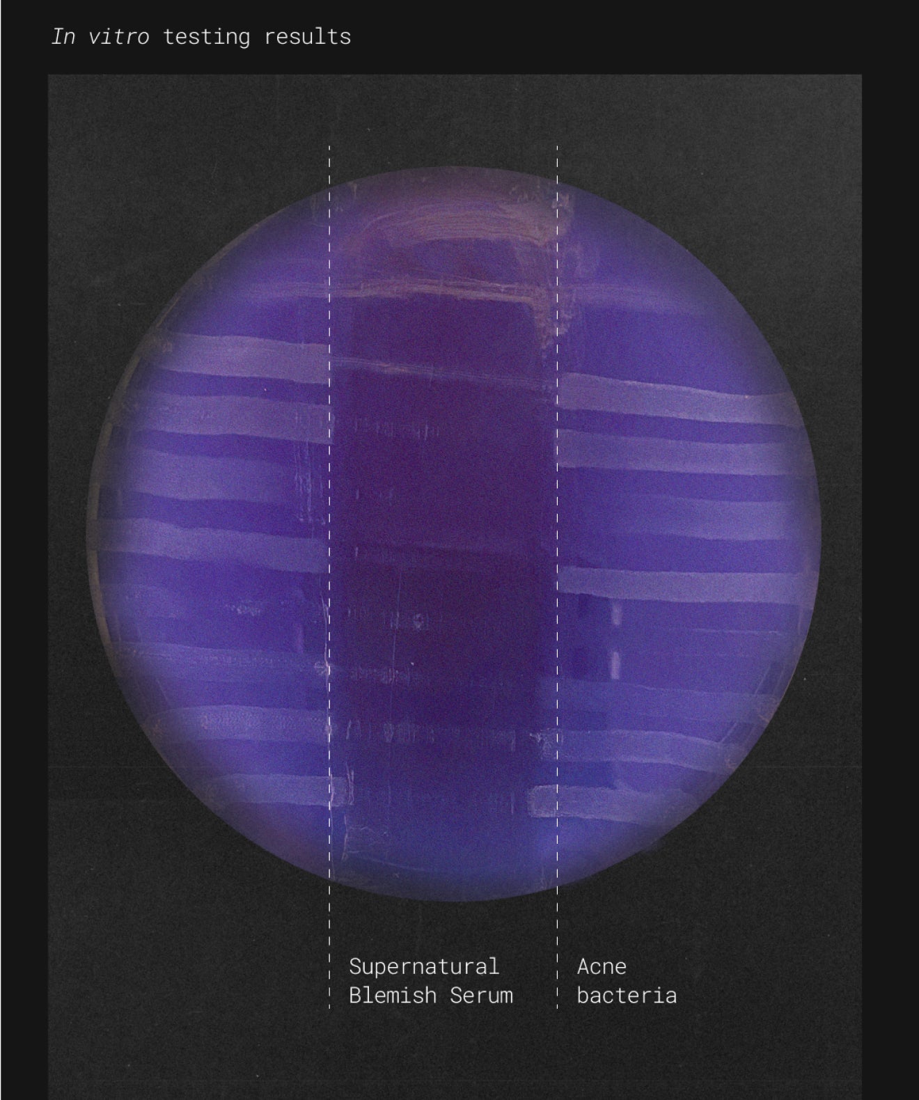 Petri dish showing In Vitro testing results