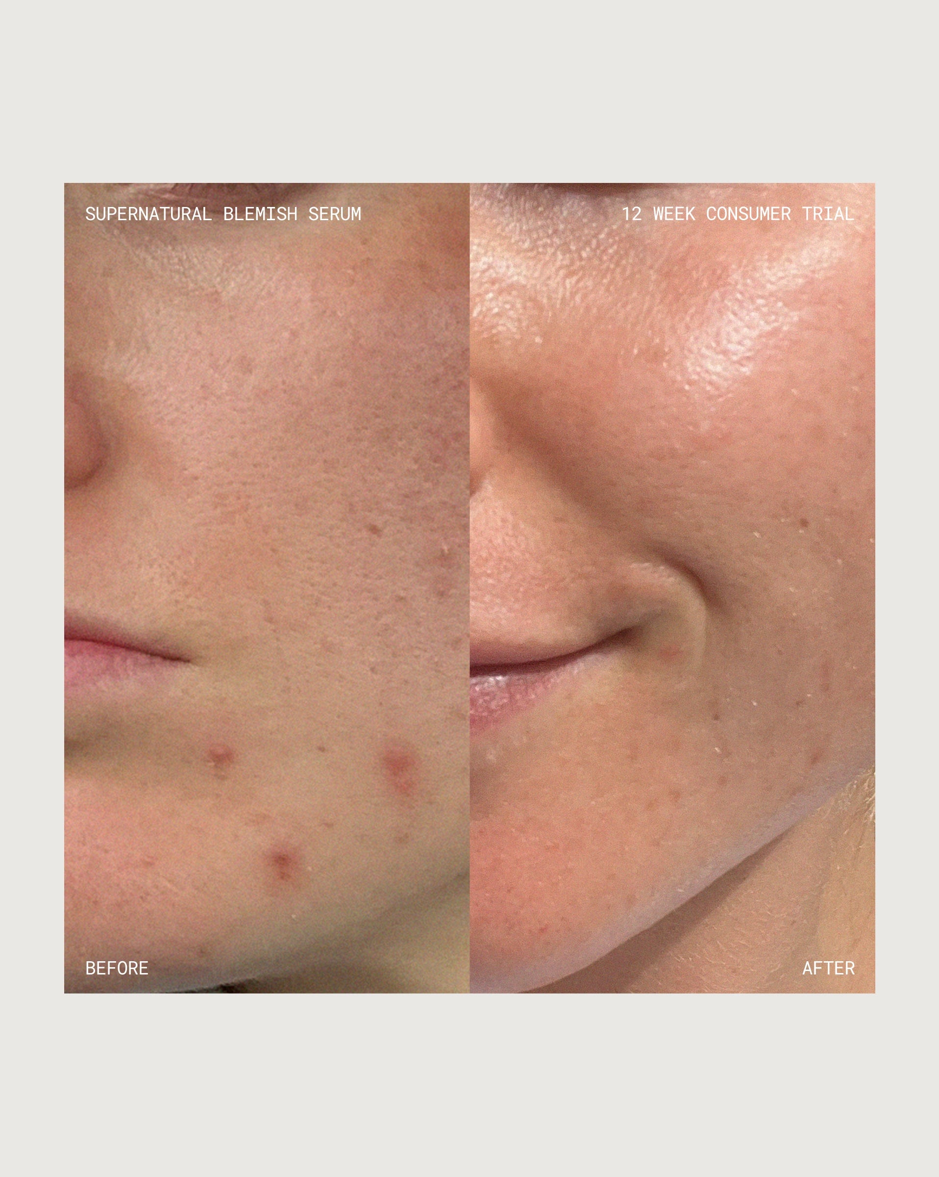 Supernatural Blemish Serum