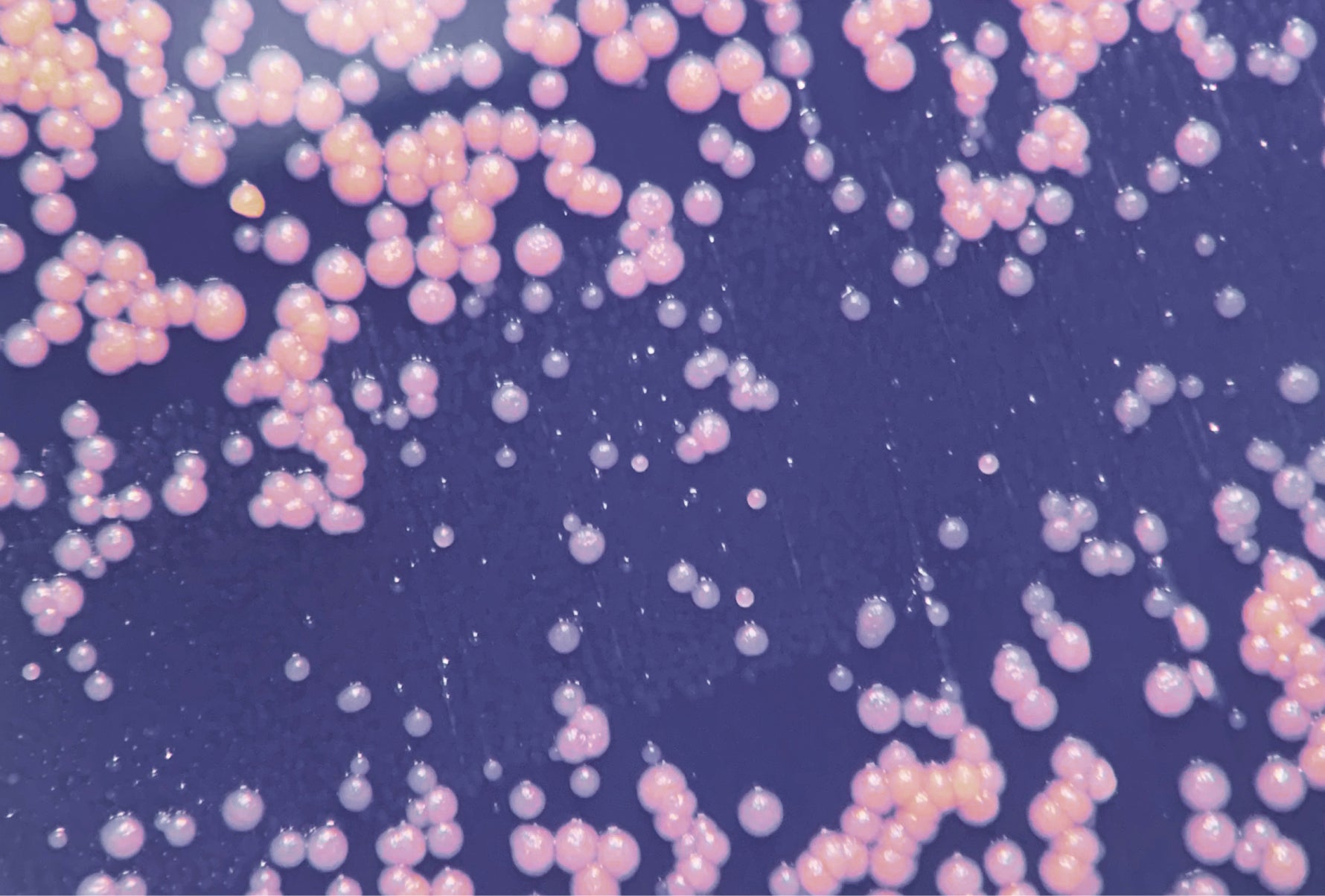 Micrococcus luteus, a live probiotic strain in our Supernatural Blemish Serum