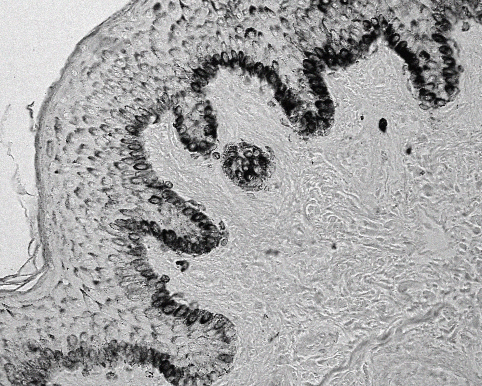 Decoding hyperpigmentation & uneven skin tone