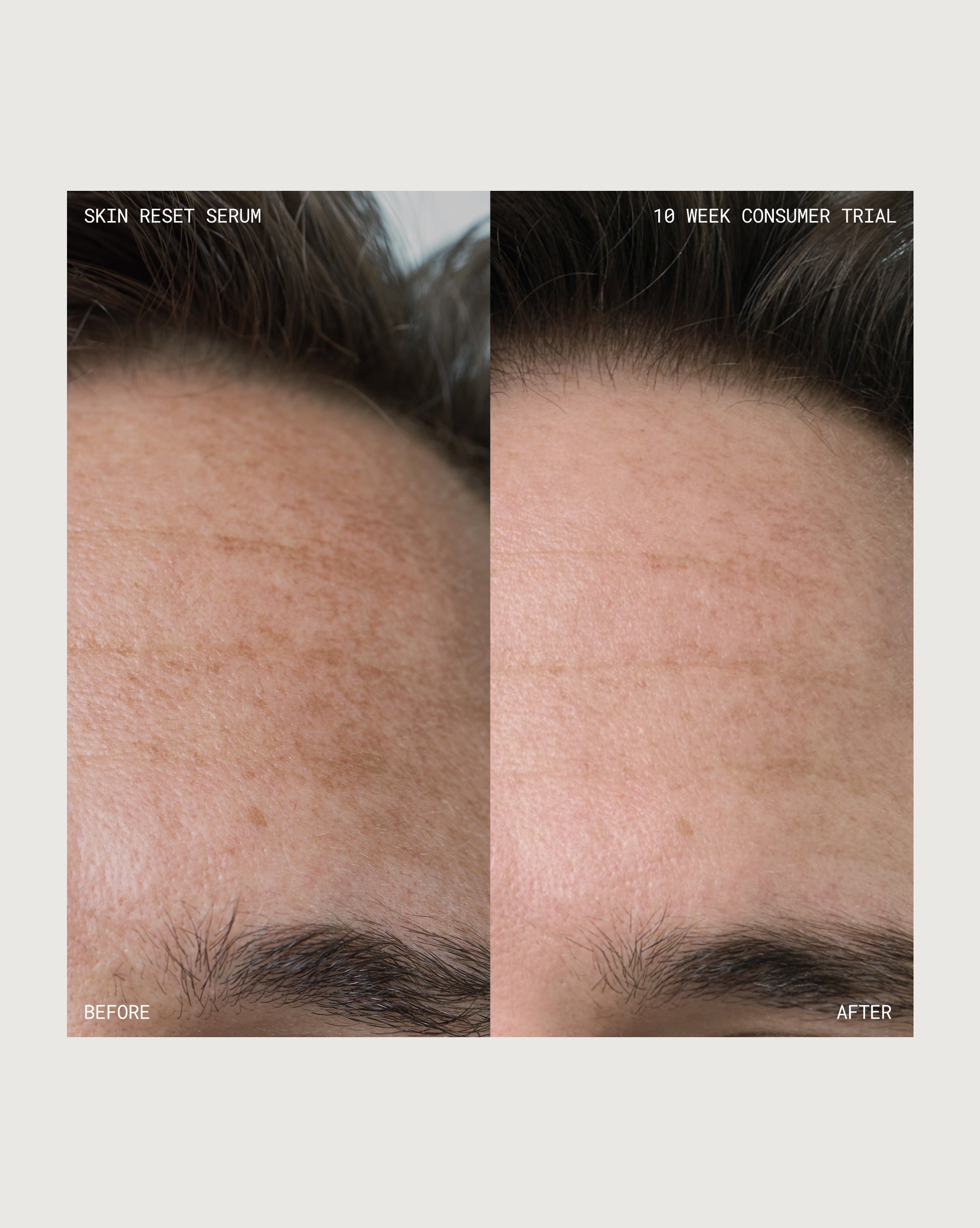 Skin Reset Serum Deluxe Mini