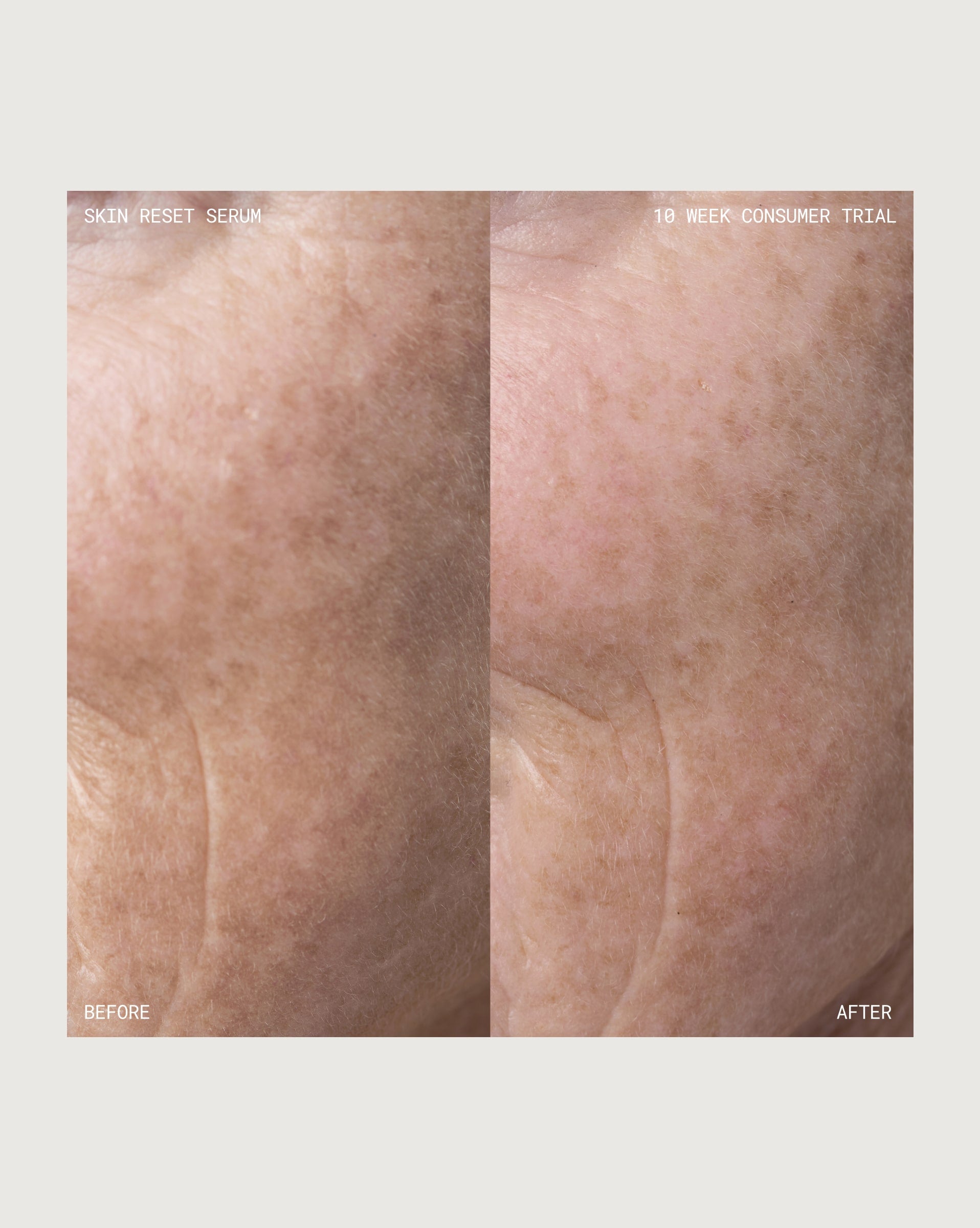Skin Reset Serum